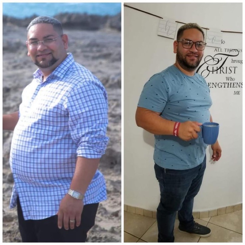 Paciente antes y después