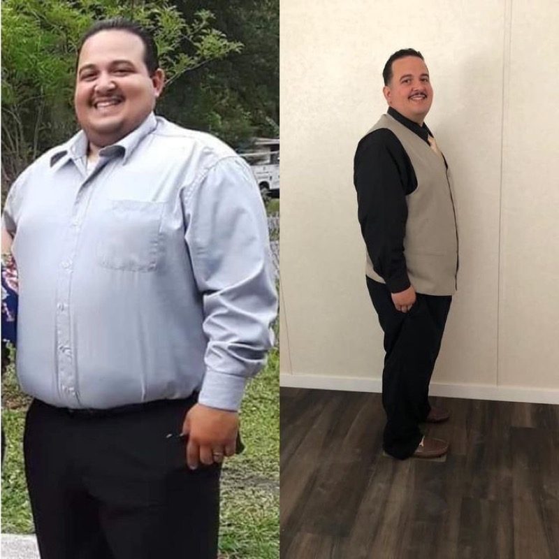 Paciente antes y después