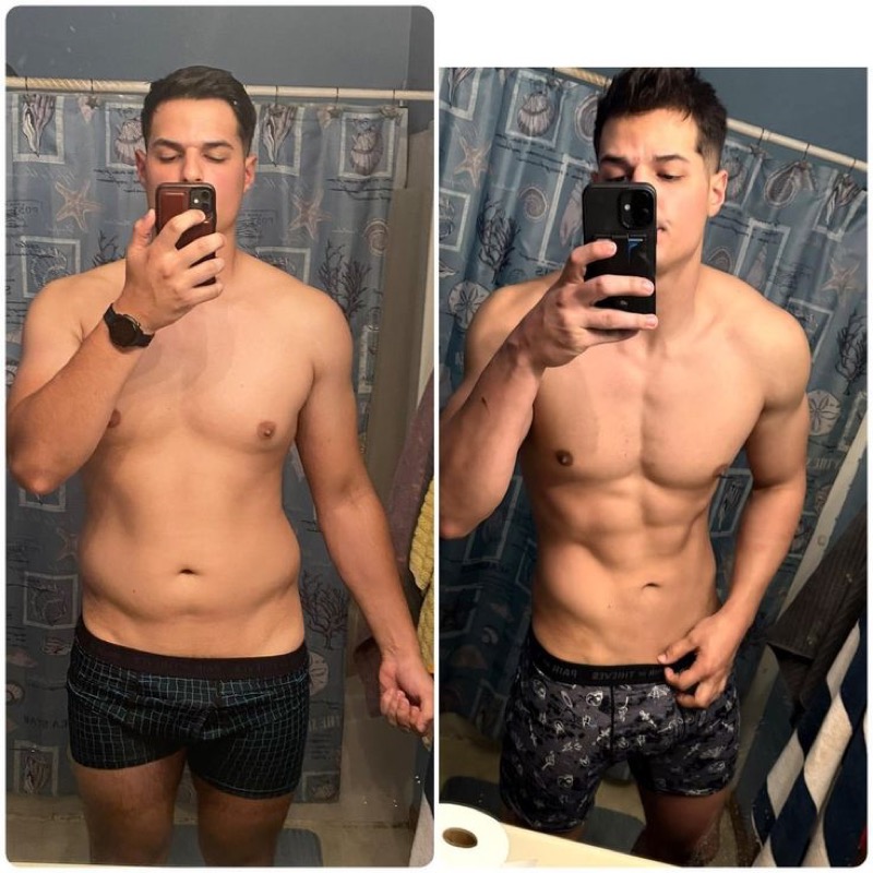 Paciente — antes y después
