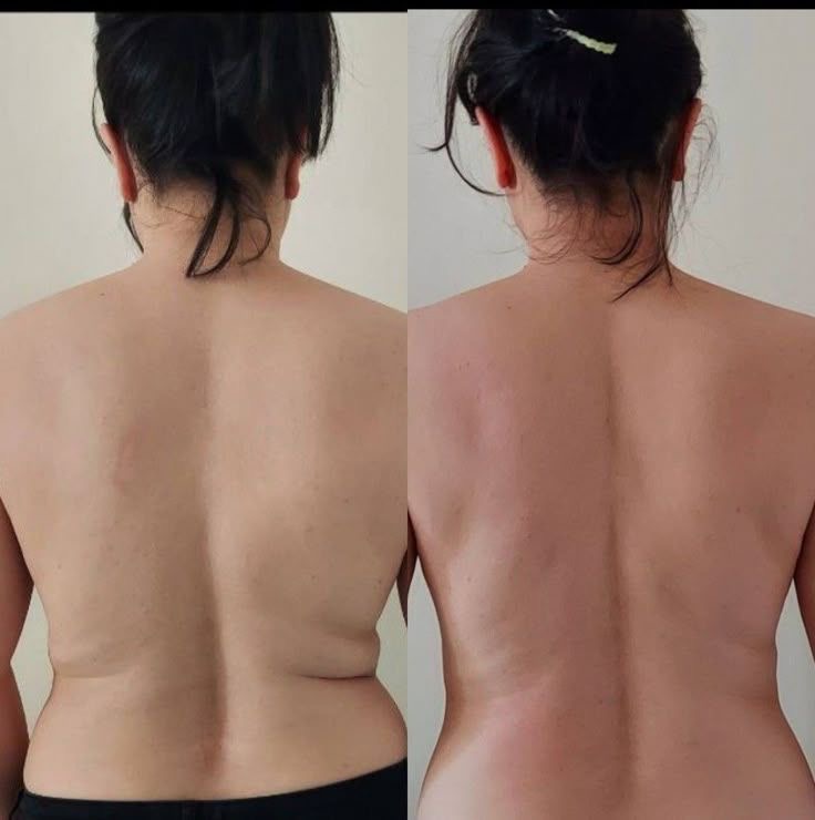 Caso 5 — vista posterior