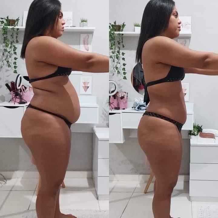 Caso 6 — vista lateral